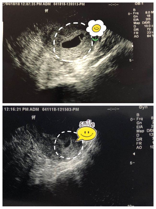 24小时接单的黑客联系方式